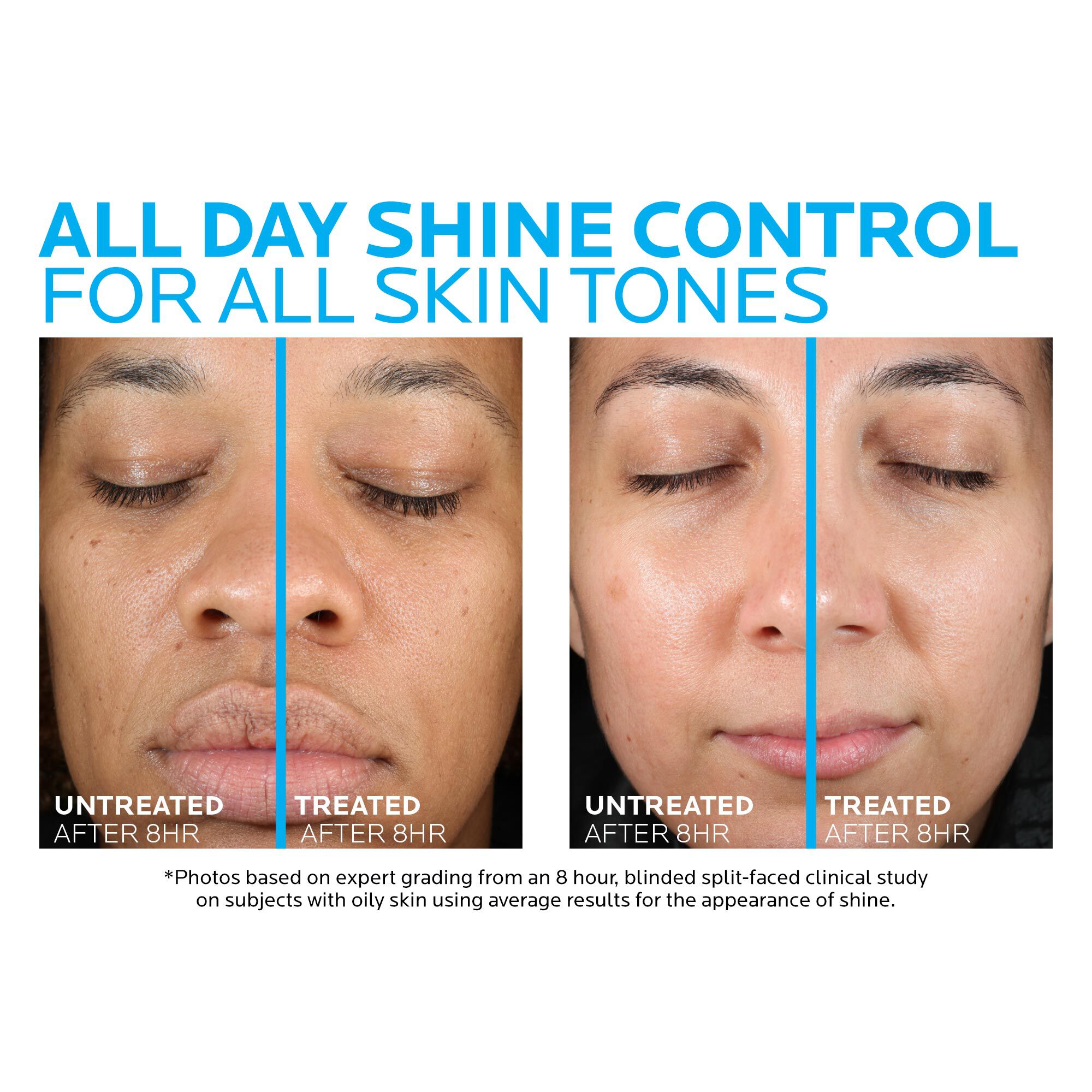 la-roche-posay-toleriane-matte-moisturizer-before-and-after-pdp-alt.jpg